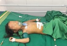 Cháu bé bị máy cắt cỏ văng vào bụng, gia đình lấy kim may “khâu sống”