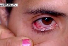 Chuyện lạ: cô gái khóc ra 50 hạt… thủy tinh mỗi ngày