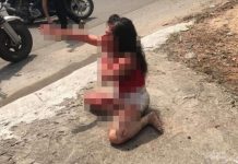 Bến Cát: Cô gái bị tình cũ rạch mặt tàn ác